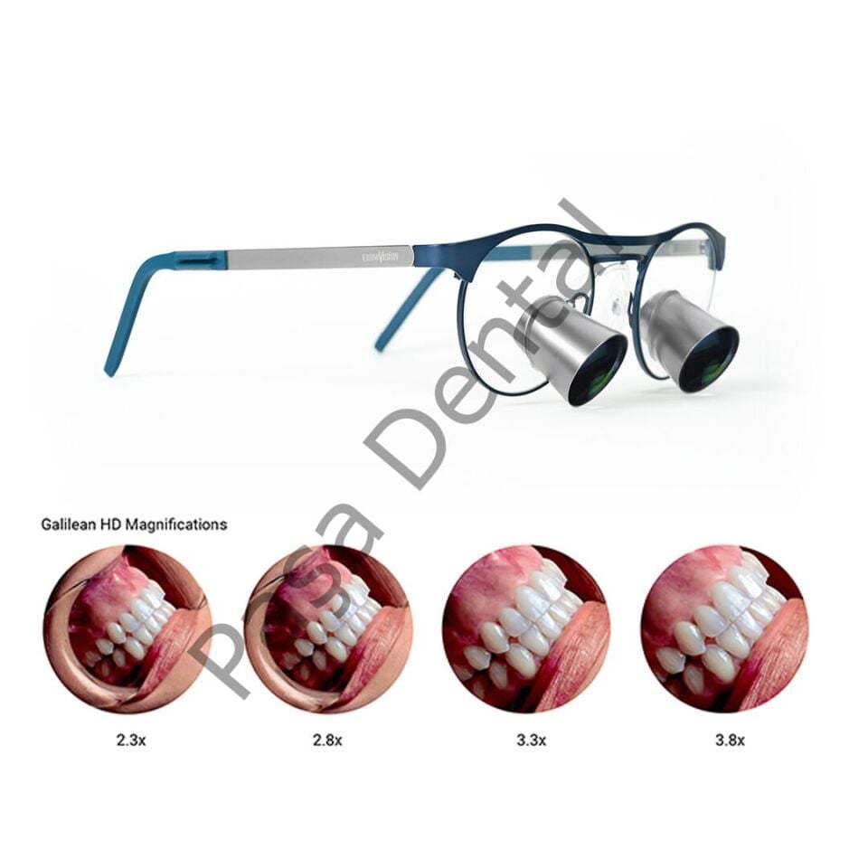 Galile HD  3,3x Loupe