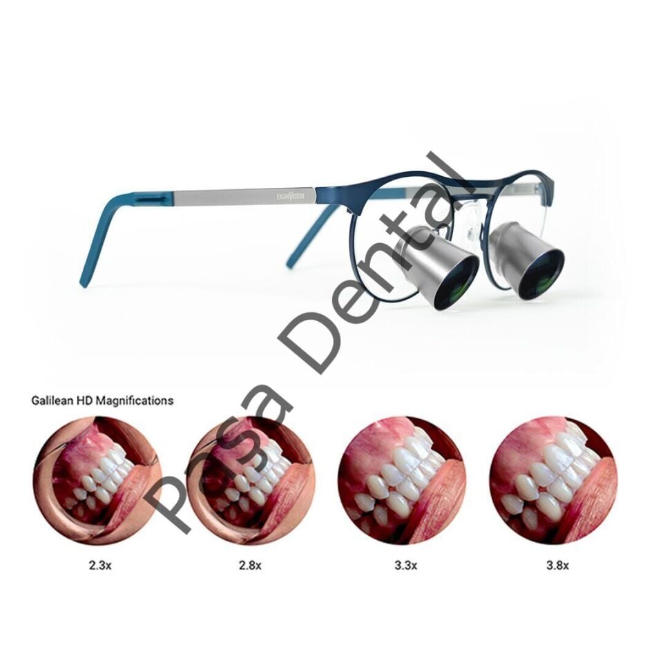 Galile HD   3,8x Loupe