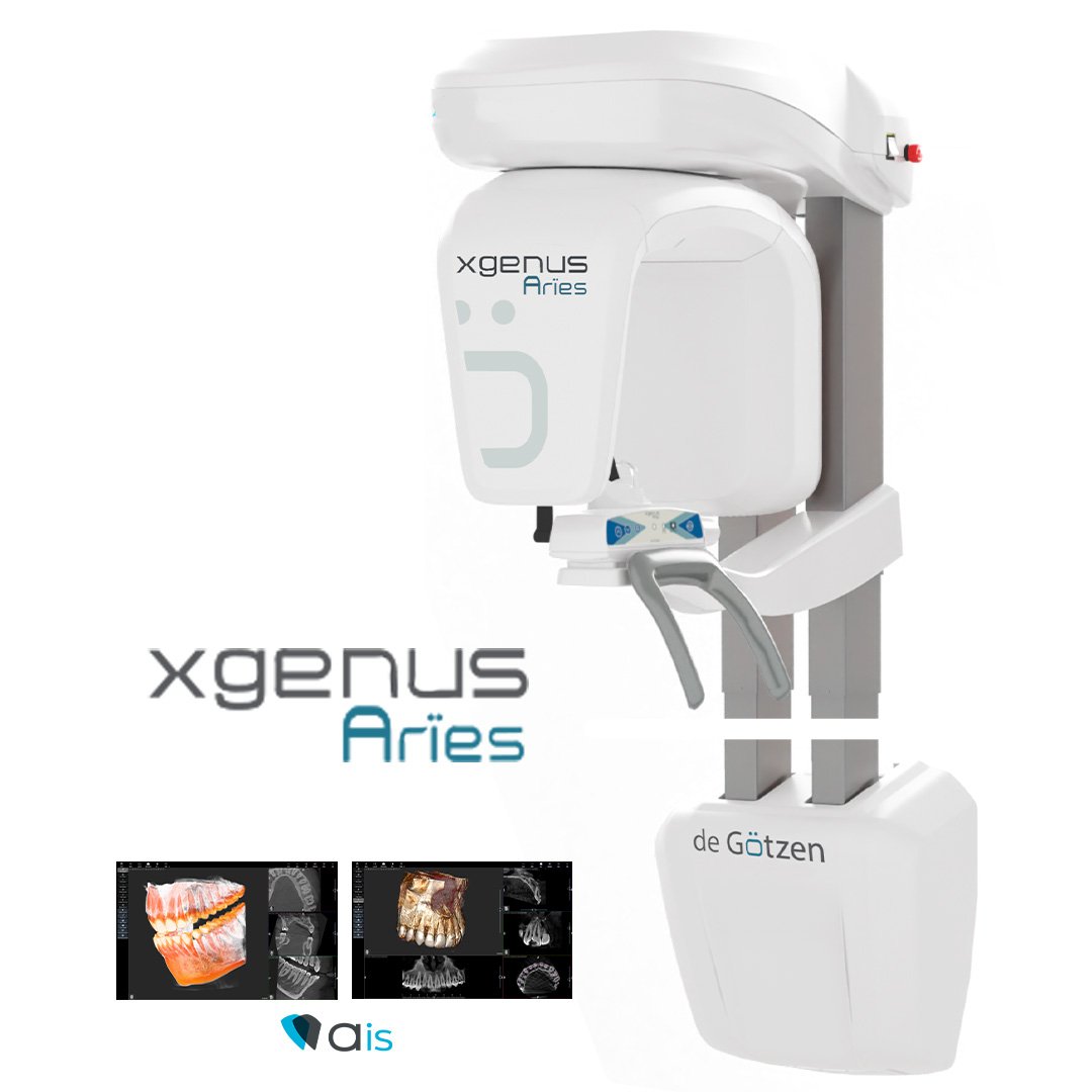 XG Aries  Panoramik Röntgen 